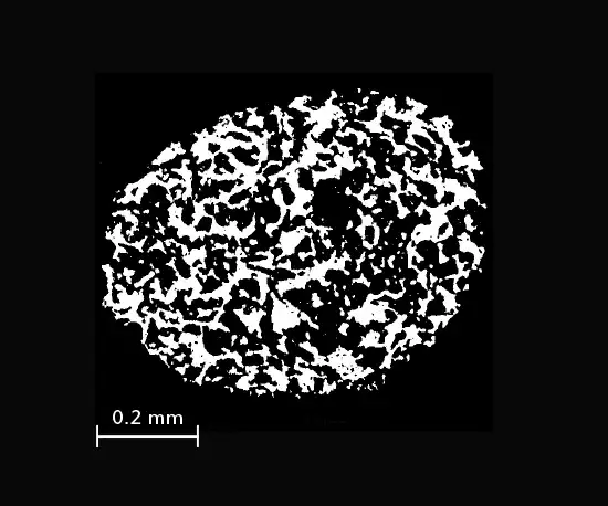 CoralPor® macroporeux