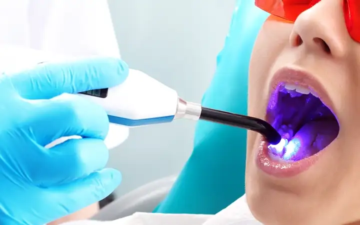 Dentiste éclairant la bouche d’un patient avec un guide de lumière SCHOTT 